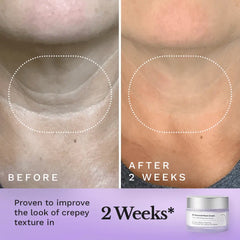 Viral tightening neck cream visible results before and after use, showcasing improved skin texture in 2 weeks.