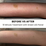 Illuminate Green V1 – Green Light Therapy Panel