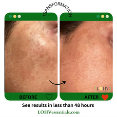 vegan glow up toner serum before and after skin transformation showing improved radiance and texture in less than 48 hours