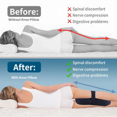 1 Piece Knee Pillow Ergonomic Side Pillow For Side Sleepers Back Legs Hips Joints Pregnancy Sciatic Neuralgia Relief