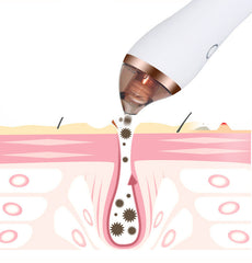 4 in 1 guasha cupping blackhead remover in action, deep cleansing skin by extracting impurities effectively | H.E.A.L Hair Care