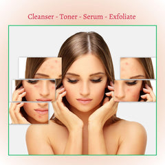 Deep Treatment Acne Cleansing Foam Cleanser [BACK IN STOCK 9/13]