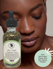 Sérum pour le visage contre l'acné