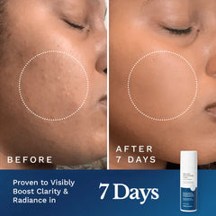 Clear Out Skin Clarifying Cream