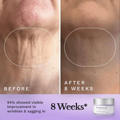 viral tightening neck cream showing dramatic results before and after 8 weeks of use, highlighting improved skin firmness and reduced wrinkles.