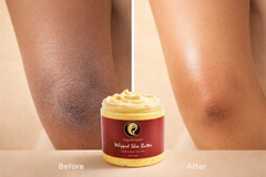 Before and after dry skin moisturizing results with an 8oz jar of honey whipped shea butter.