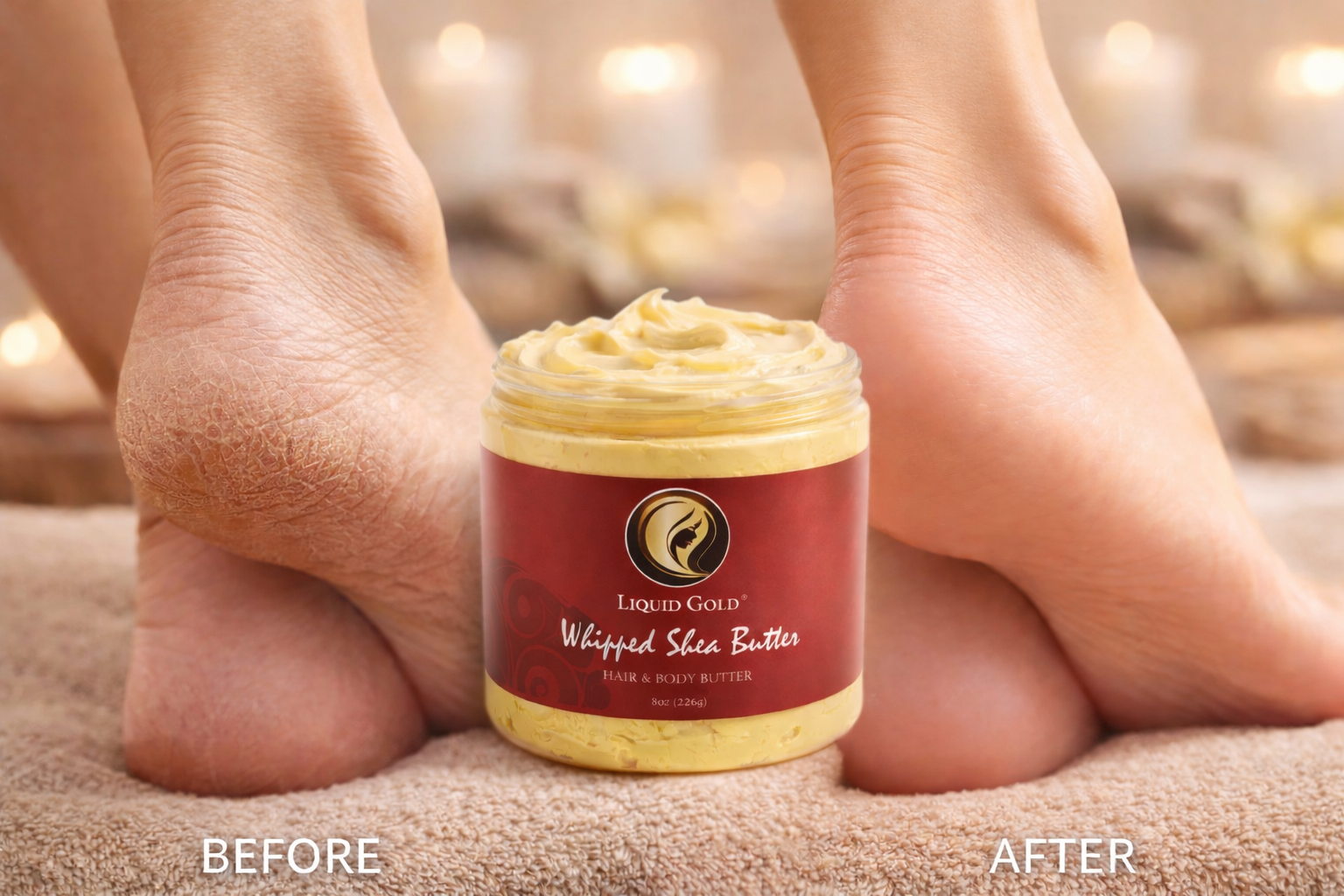 Before and after cracked heels treated with an 8oz jar of honey whipped shea butter for smooth, nourished skin.