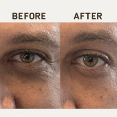 Papatui Ageless Action Technology Under Men's Eye Patch 6 unidades - Caja imperfecta