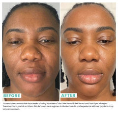 Urban Skin Rx Youth Hero 2-in-1 AM Serum & PM Serum - Imperfect Box