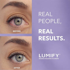 Lumify Eye Drops for Redness Relief 2.5ml - New