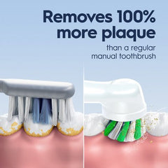 Cepillo de dientes eléctrico recargable Oral-B Pro 1000, rosa - Caja imperfecta