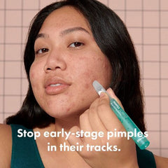 Hero Pimple Correct Pen 0.34 fl oz EXP 05/2026 - Imperfect Box