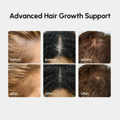 4-in-1 Hair Growth Spray