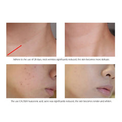 ARTISCARE Hyaluronic Acid Hydrating Serum