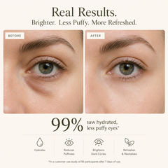 Hydrogel Eye Mask