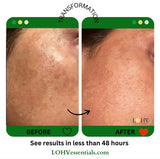 PREMIUM 100% VEGAN GLOW UP Toner Serum With Hyaluronic Acid + Niacinamide + Camellia Leaf + Vitamin E + Rose Water