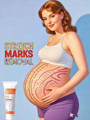 Cream For Pregnancy Stretch Marks Removal Eliminate Red White Old Stretch Marks 26