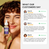 Dark Spot Serum for Normal Skin