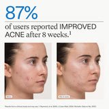 Nutrafol Clear Skin Nutraceutical Acne Supplement 3-Month Supply