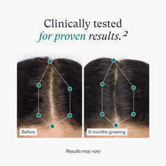 Clinically tested image showing before and 6 months of results for Nutrafol women's hair growth supplement.