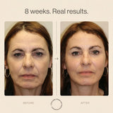 Nicebeam 9-in-1 Laser Light Therapy Lamp for Skin & Hair Rejuvenation